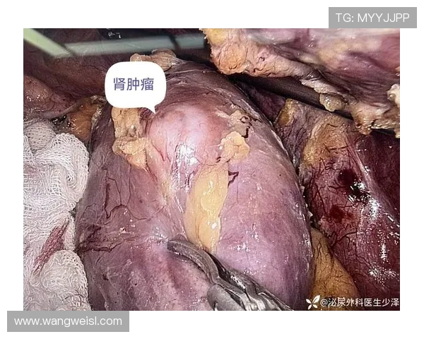 从肾癌病房到商业帝国:韦德如何用三重身份重塑人生(3)